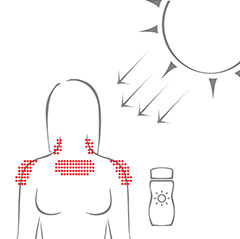 Mallorca-Akne entsteht durch die Reaktion von Sonnenschutzmitteln oder Hauttalg mit der UV-Strahlung.